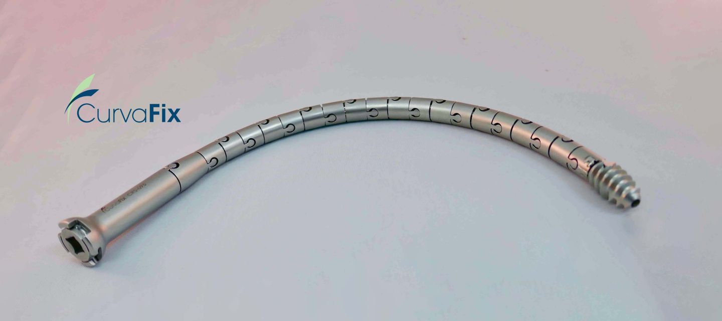 The CurvaFix Implant: a long curved piece of interlocking metal "puzzle pieces" 